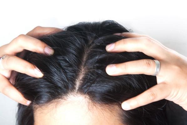 Massaggio-capelli-e-cuoio-capelluto-ecco-un-rimedio-anti-caduta